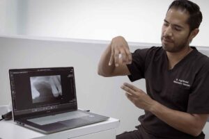 La importancia de los implantes dentales para mejorar la calidad de vida de los adultos mayores
