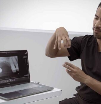 La importancia de los implantes dentales para mejorar la calidad de vida de los adultos mayores